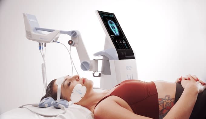 emface nonsurgical facelift