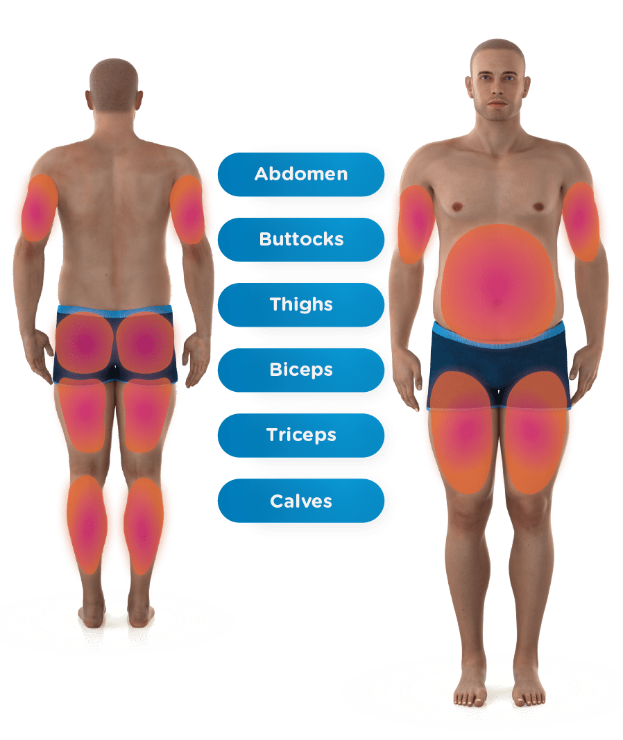 body areas suitable for Emsculpt NEO treatment