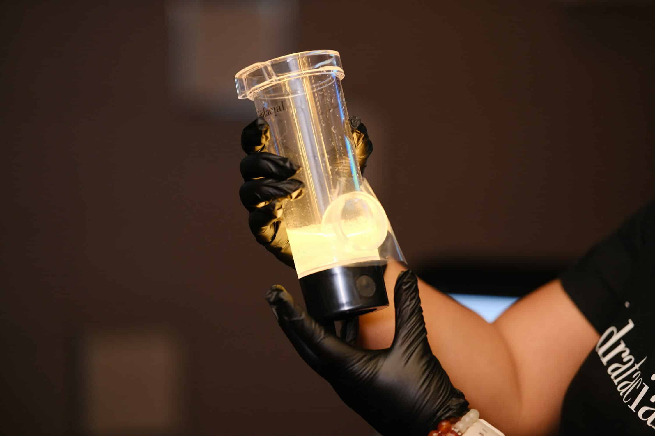 hydrafacial gunk jar with impurities and dirt from the skin