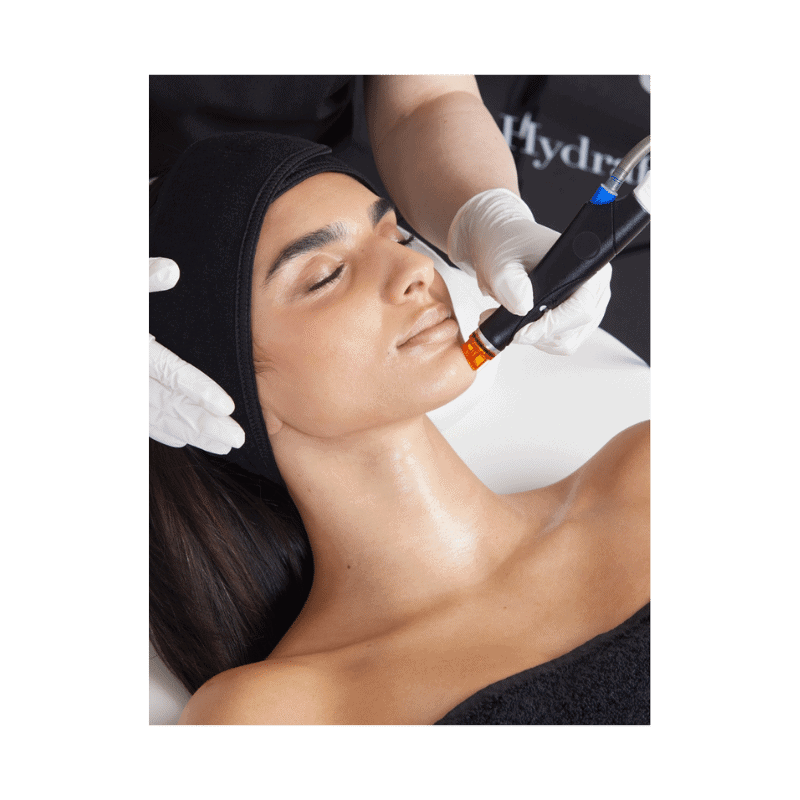 hydrafacial service at Glow Medispa