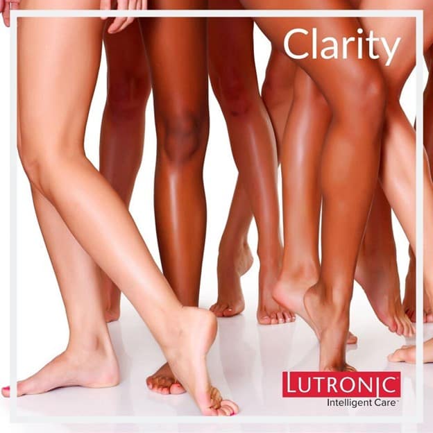Clarity II laser hair removal