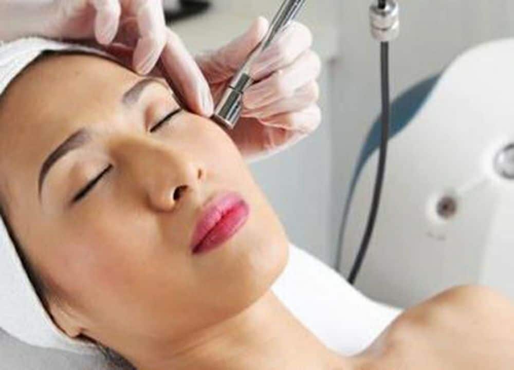 microdermabrasion treatment