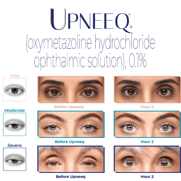 upneeq before and after