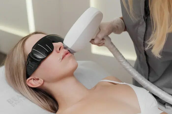 Laser hair removal face